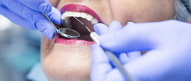 Best Emergency Root Canal Treatment in Swepsonville, NC